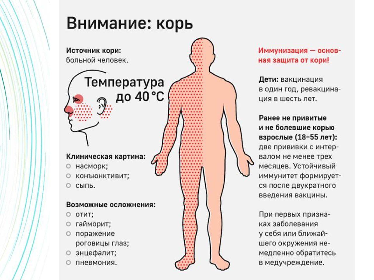 Рассказываем о кори.